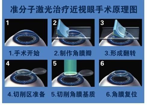 下载 (1).jpg